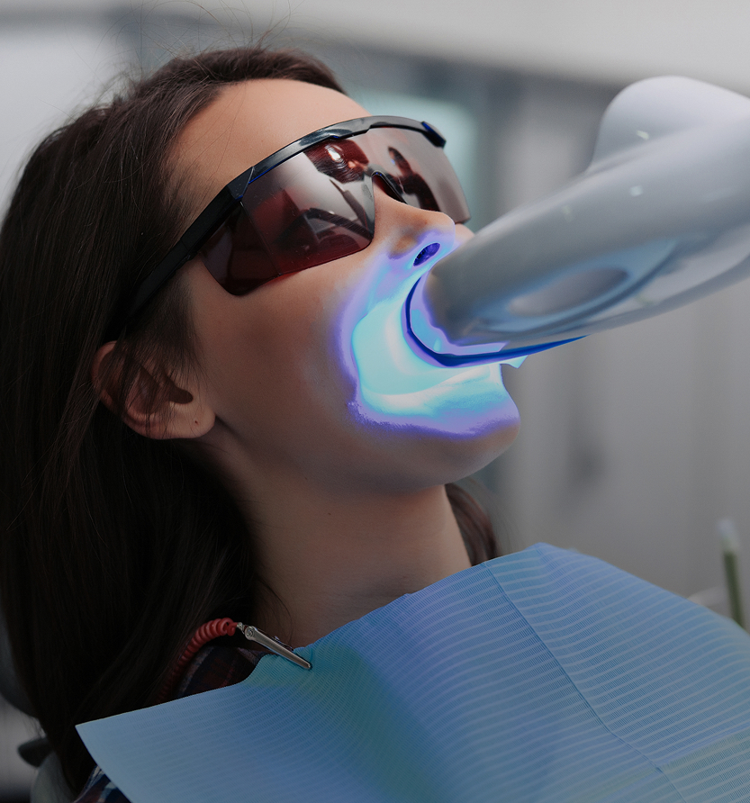 Blanchiment à la chaise avec ZOOM Blanchiment à la chaise avec ZOOM