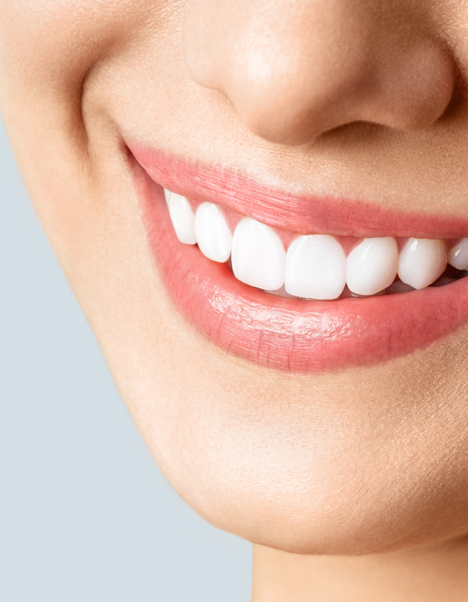 Blanchiment des dents à Angus-Montréal Blanchiment des dents à Angus-Montréal