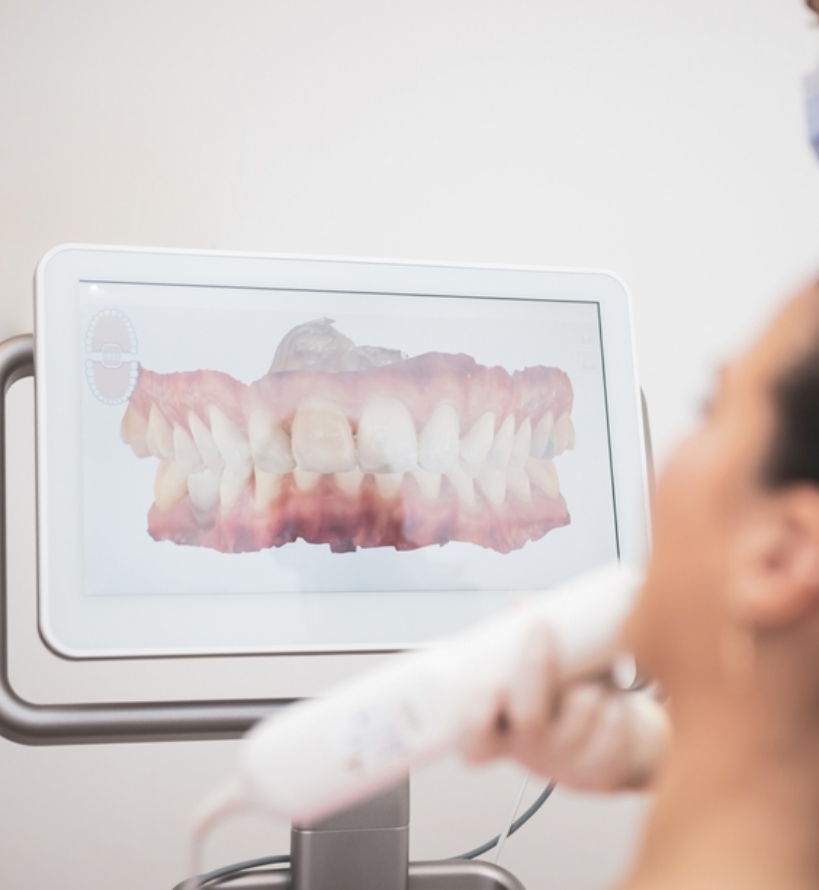 Comment fonctionne un traitement Invisalign ?
Comment fonctionne un traitement Invisalign ?