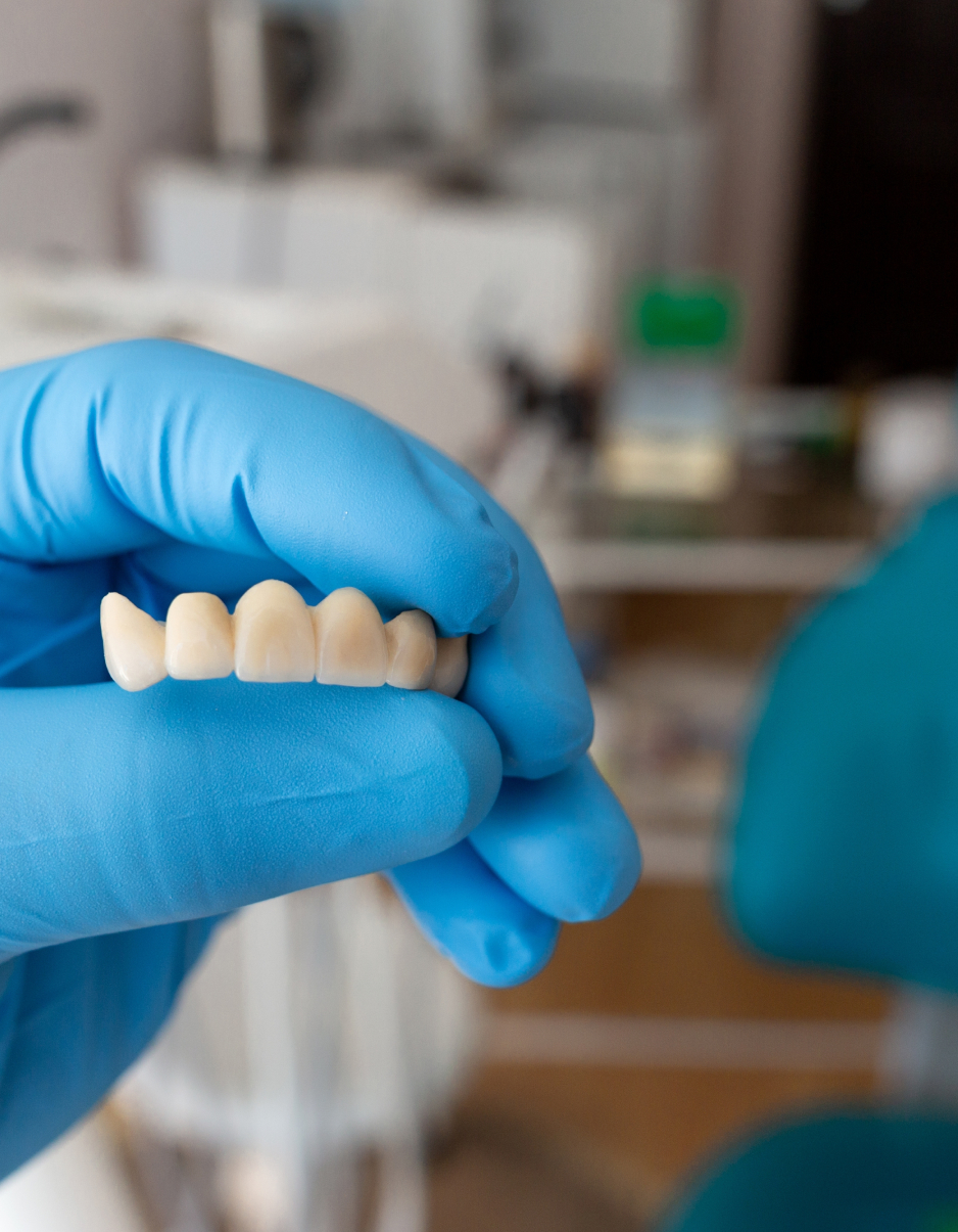 Couronne et pont : restaurer votre sourire avec des solutions durables Couronne et pont : restaurer votre sourire avec des solutions durables