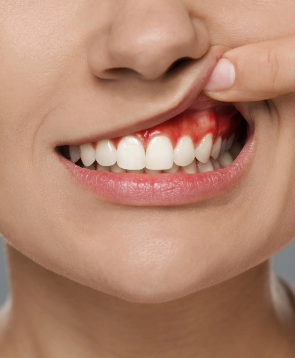 Dentisterie esthétique Dentisterie esthétique