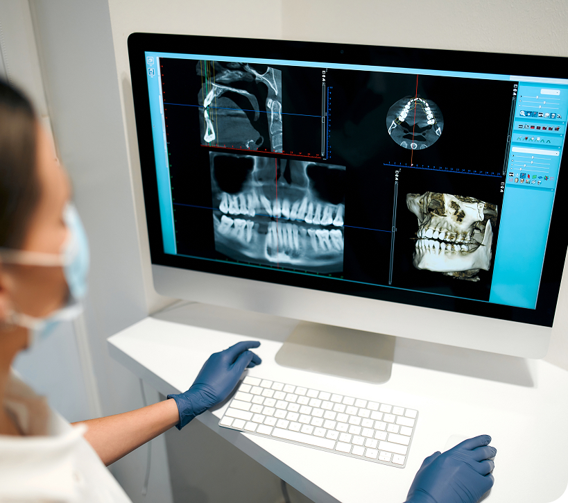 Les étapes du soin d’une carie Les étapes du soin d’une carie