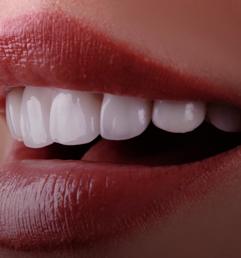 Prothèses dentaires service Prothèses dentaires : Une solution pour retrouver le sourire