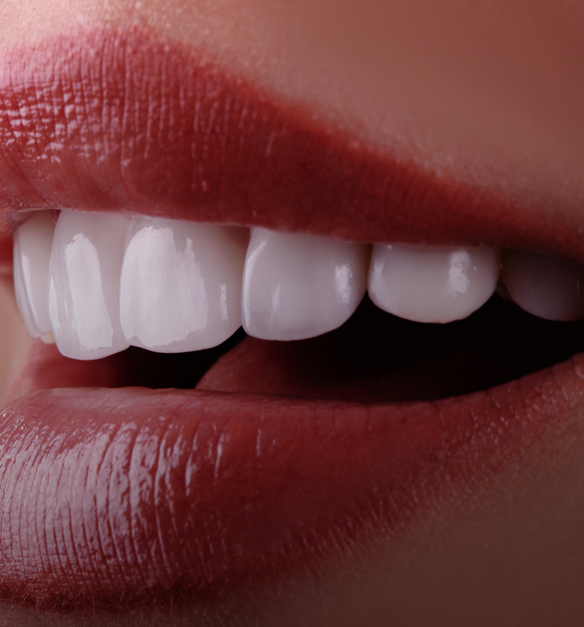 Quels sont les avantages des couronnes et ponts dentaires Quels sont les avantages des couronnes et ponts dentaires ?