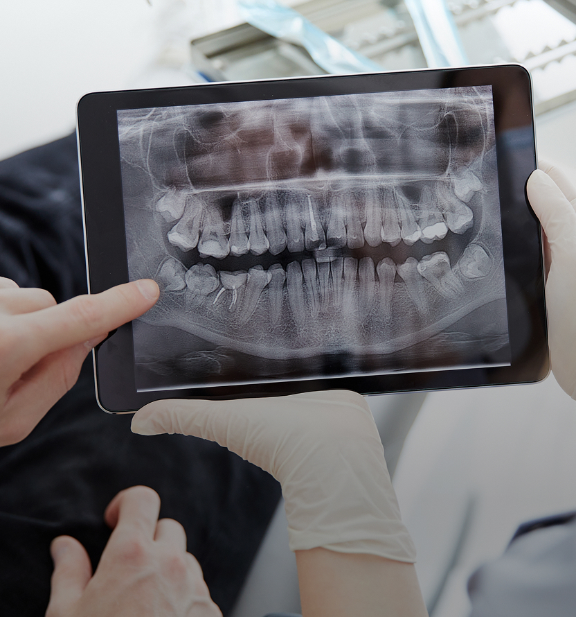 Radiologie numérique Radiologie numérique