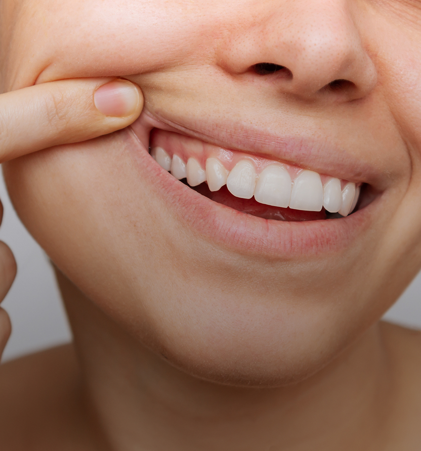 Soins des gencives services Soins des gencives : Préserver la santé buccodentaire